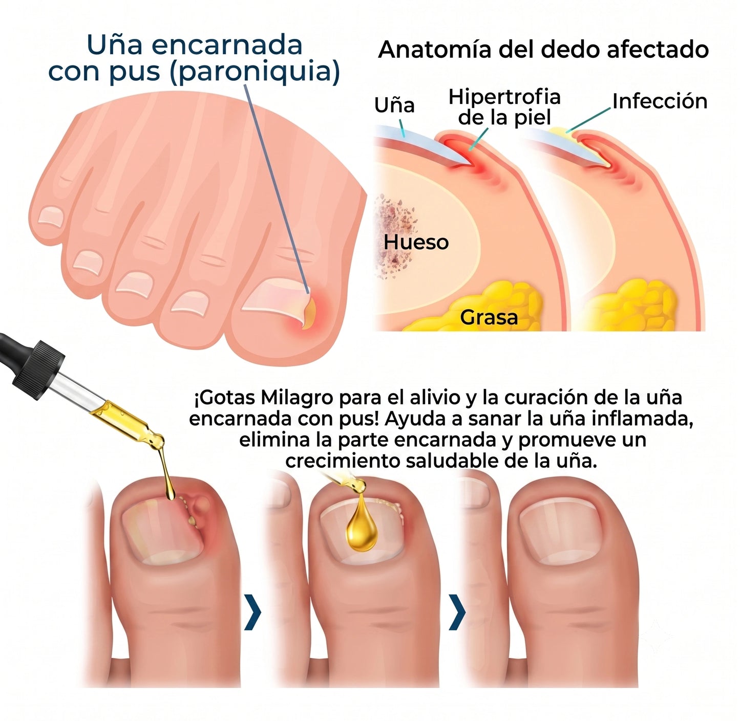 GOTAS MILAGRO