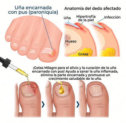 GOTAS MILAGRO